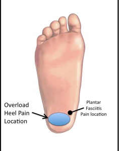 continuous pain in heel