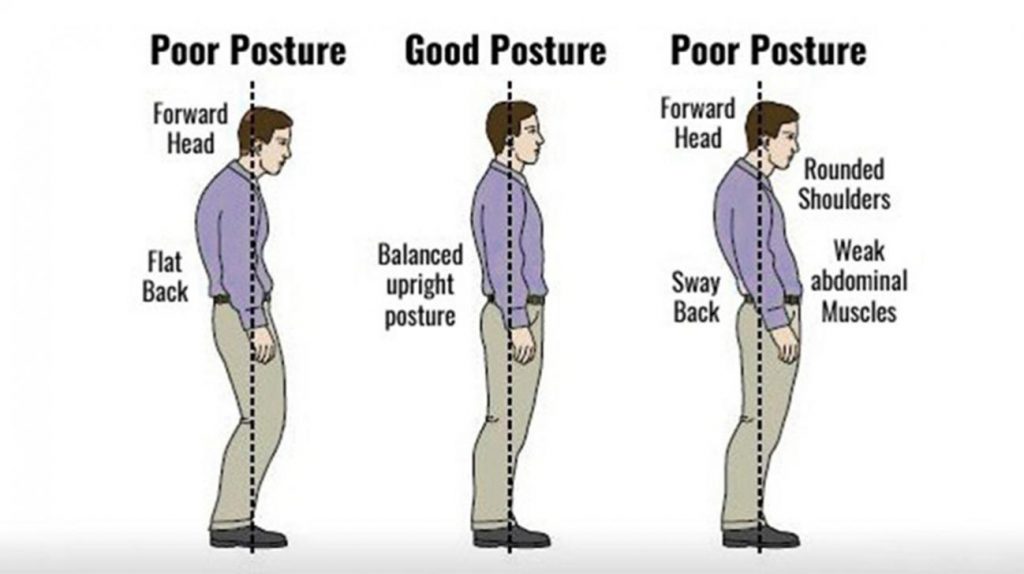 Poor Posture Archives Physiotherapists in Tralee